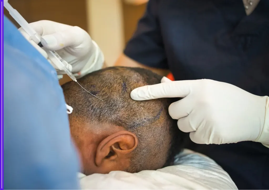 Indo-US Scientists Crack the Molecular Code of Hair Loss, Opening Path to Regrowth Without Transplants 1 Indo-US Scientists Crack the Molecular Code of Hair Loss, Opening Path to Regrowth Without Transplants