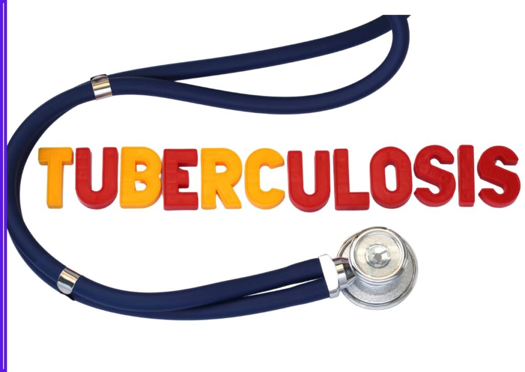 Tamil Nadu Becomes First Indian State to Use AI Model to Predict Tuberculosis Death Risk 1 Tamil Nadu Becomes First Indian State to Use AI Model to Predict Tuberculosis Death Risk