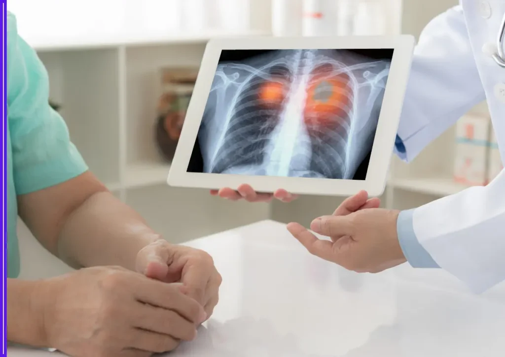 Bengaluru IT Professional, 34, and Panipat Teacher, 43, Diagnosed with Lung Cancer Despite No Smoking or Unhealthy Habits